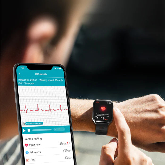 ECG Smartwatches: A Revolutionary Tool For Personal Health Monitoring