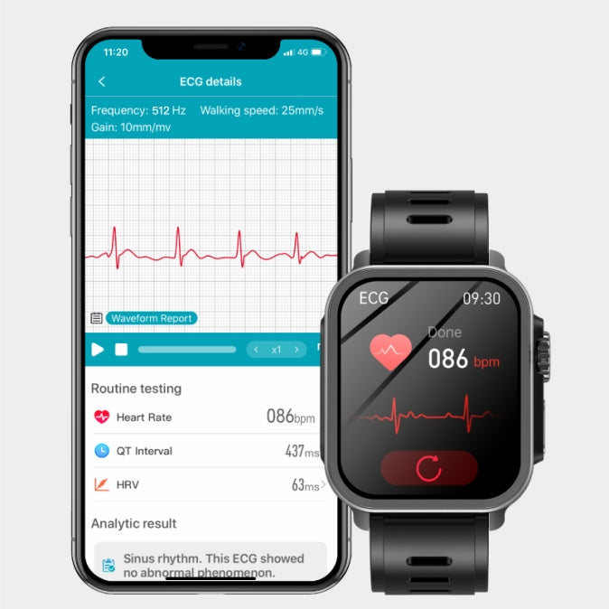 Is There a Smart Watch with Blood Pressure and Heart Rate Monitor?
