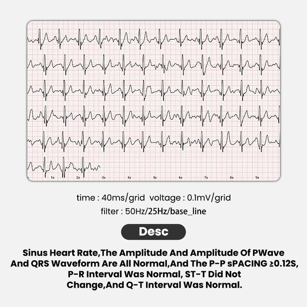 ECG Report Based On Big Data