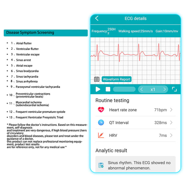 ECG Atrial Fibrillation Screening+ Current Status